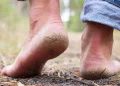 راهکارهای خانگی مؤثر برای درمان ترک پا