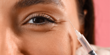 سیاهی زیر چشم: علل و راه‌های درمان